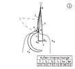 External- internal lever
