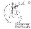 External- internal lever with one tip 63