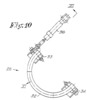 View of the device according to the F10 of the figure 1