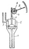 RACK-AND-PINION MECHANISM OF A FLOAT-TYPE DIFFERENTIAL MANOMETER WITH CONCENTRIC VESSELS