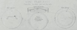 Coperchio inodoro