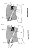 Double Toroidal Rotary Thermal Engine - Assembly view of the brake piston element
