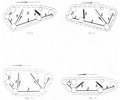 Kinematic scheme of chain tracked polygon for all positions