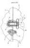 Foot Support Mounting Detail