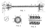 Alternate reverse torsion machine and two ways to define the supplying trajectories