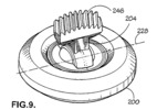 Assembly of the configuration of the roller, bracket and bearing