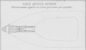 Tav. LX, Voruz Antoine Arthure, Perfectionnnements apportés aux fasées perculantes pour projectiles