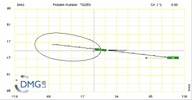 Six bar linkage. Slider crank kinematic chain connected in parallel with a slider crank-1 (Variant 3)