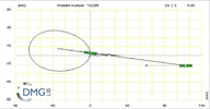 Six bar linkage. Slider crank kinematic chain connected in parallel with a slider crank-1 (Variant 5)