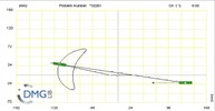 Six bar linkage. Slider crank kinematic chain connected in parallel with a slider crank-1 (Variant 10)