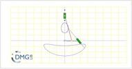 Six bar linkage. Slider crank kinematic chain connected in parallel with an inverted slider crank -2 (Variant 1)