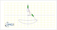 Six bar linkage. Slider crank kinematic chain connected in parallel with an inverted slider crank -2 (Variant 12)