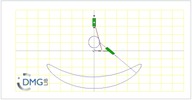 Six bar linkage. Slider crank kinematic chain connected in parallel with an inverted slider crank -2 (Variant 14)
