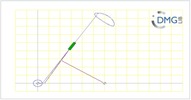 Six bar linkage. Inverted slider crank kinematic chain connected in parallel with a four bar linkage -1 (Variant 5)