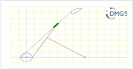 Six bar linkage. Inverted slider crank kinematic chain connected in parallel with a four bar linkage -1 (Variant 12)