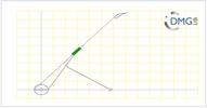 Six bar linkage. Inverted slider crank kinematic chain connected in parallel with a four bar linkage -1 (Variant 14)