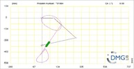 Six bar linkage. Inverted slider crank kinematic chain connected in parallel with a four bar linkage -2 (Variant 2)