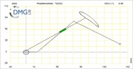 Six bar linkage. Inverted slider crank kinematic chain connected in parallel with a four bar linkage -4 (Variant 20)