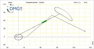 Six bar linkage. Inverted slider crank kinematic chain connected in parallel with a four bar linkage -4 (Variant 21)