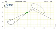 Six bar linkage. Inverted slider crank kinematic chain connected in parallel with a four bar linkage -4 (Variant 22)