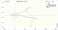 Six bar linkage. RRR kinematic chain connected in parallel with a four bar linkage -1 (Variant 12)