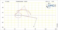 Six bar linkage. RRR kinematic chain connected in parallel with a four bar linkage -1 (Variant 20)