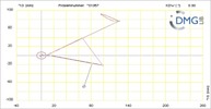Six bar linkage. RRR kinematic chain connected in parallel with a four bar linkage -3 (Variant 2)