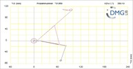 Six bar linkage. RRR kinematic chain connected in parallel with a four bar linkage -3 (Variant 4)