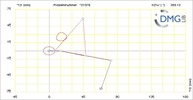 Six bar linkage. RRR kinematic chain connected in parallel with a four bar linkage -3 (Variant 20)