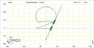 Six bar linkage. RRT kinematic chain connected in parallel with an inverted slider crank -1 (Variant 9)