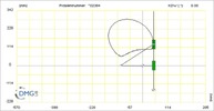 Six bar linkage. RRT kinematic chain connected in parallel with an inverted slider crank -1 (Variant 18)